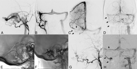 FIG 1.