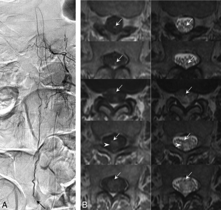 FIG 2.