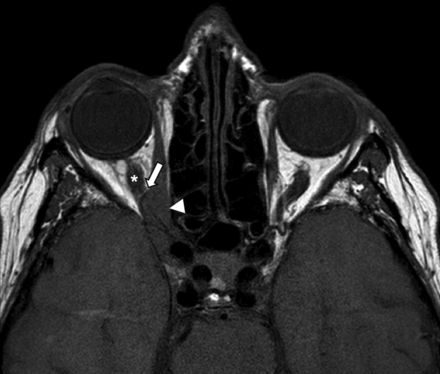 FIG 2.