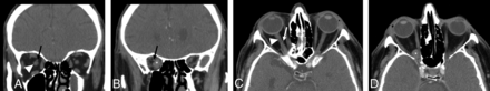 FIG 4.
