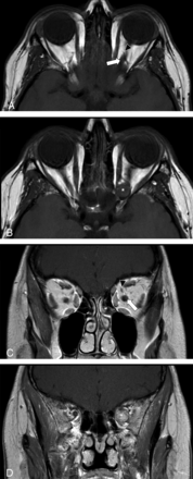 FIG 5.