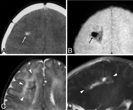FIG 2.