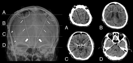 FIG 1.