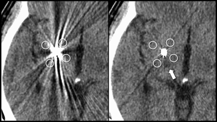 FIG 2.