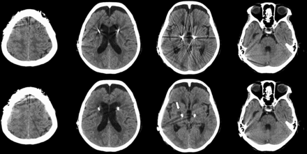 FIG 3.