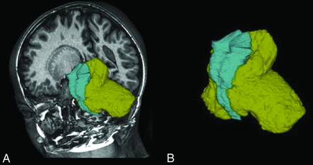 FIG 2.