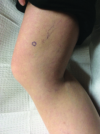 Fig 2.