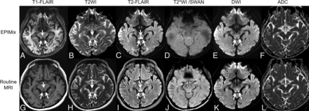 Fig 3.