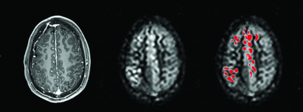 Fig 1.