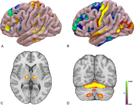Fig 3.