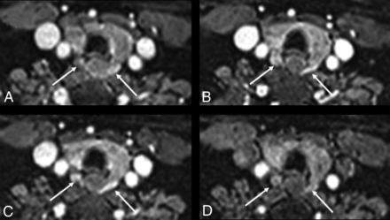 Fig 1.