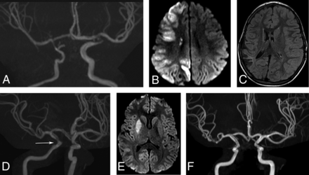 Fig 3.
