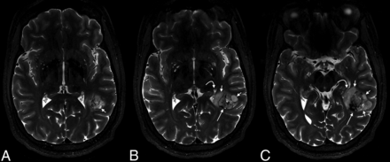 Fig 2.
