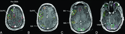 Fig 3.