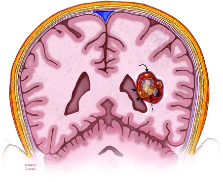 Fig 5.