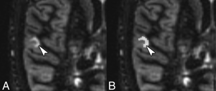 Fig 1.