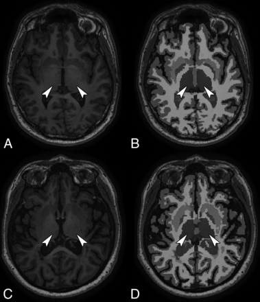 Fig 3.