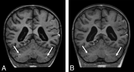 Fig 5.