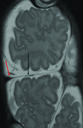 Fig 3.