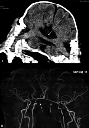 Fig 5.