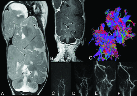 Fig 8.