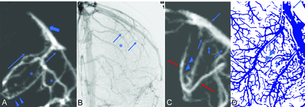Fig 2.