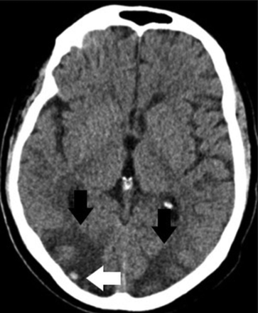 FIG 1.