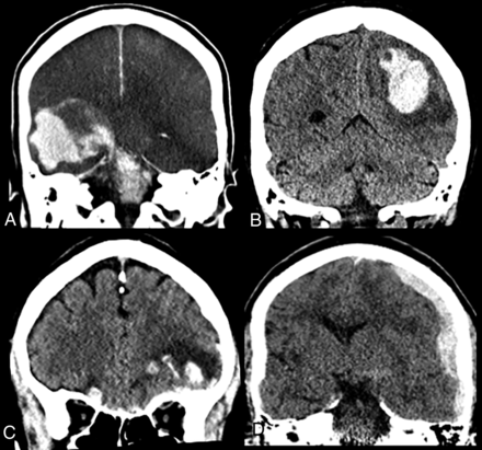 FIG 1.