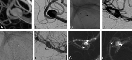 FIG 4.