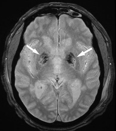 Fig 2.