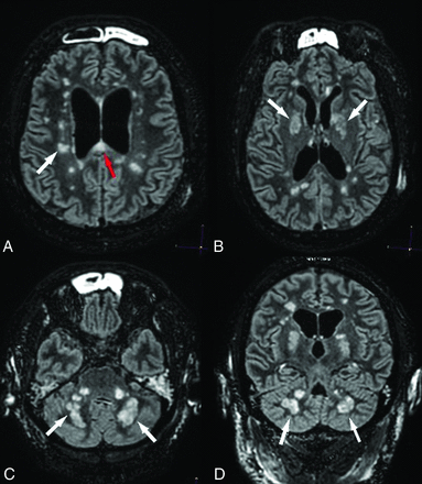 Fig 4.