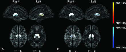 Fig 3.