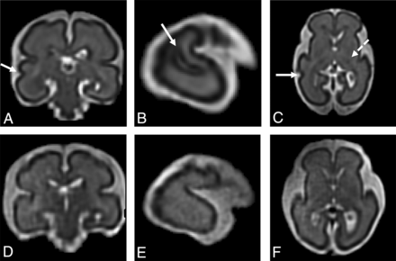 Fig 2.