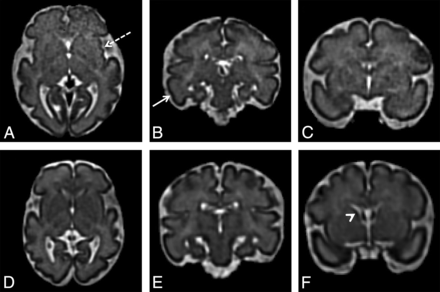 Fig 3.