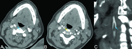 Fig 1.