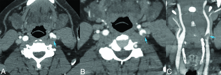 Fig 2.