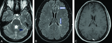 FIG 1.