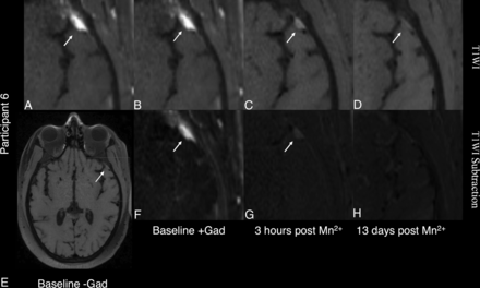 FIG 4.
