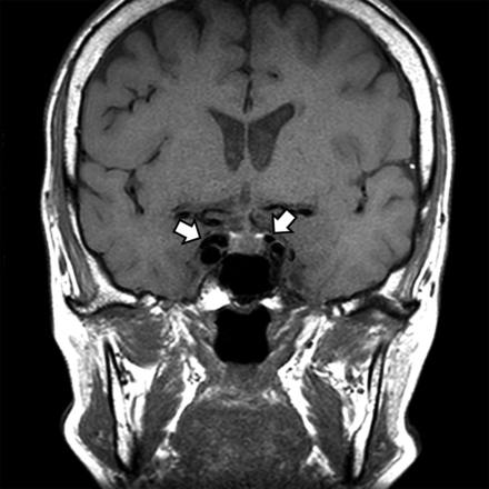 FIG 3.