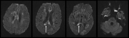 FIG 3.