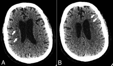 FIG 1.