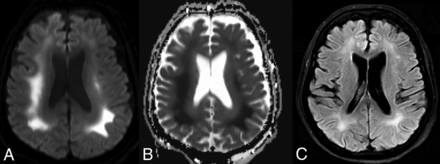 FIG 3.