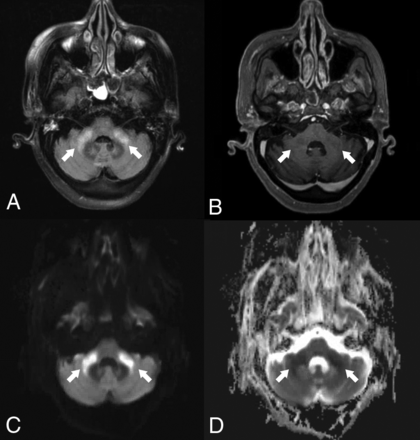FIG 4.