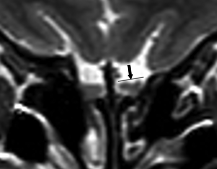 FIG 2.
