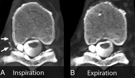 FIG 1.