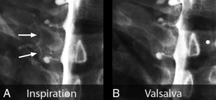 FIG 2.