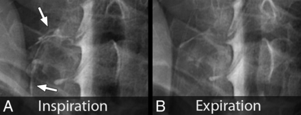 FIG 4.