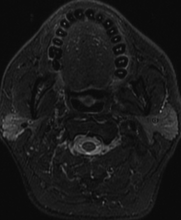 FIG 1.