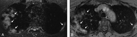 FIG 2.