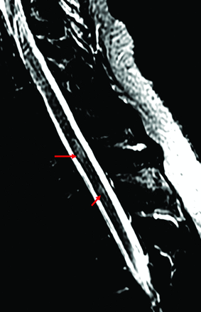 FIG 2.